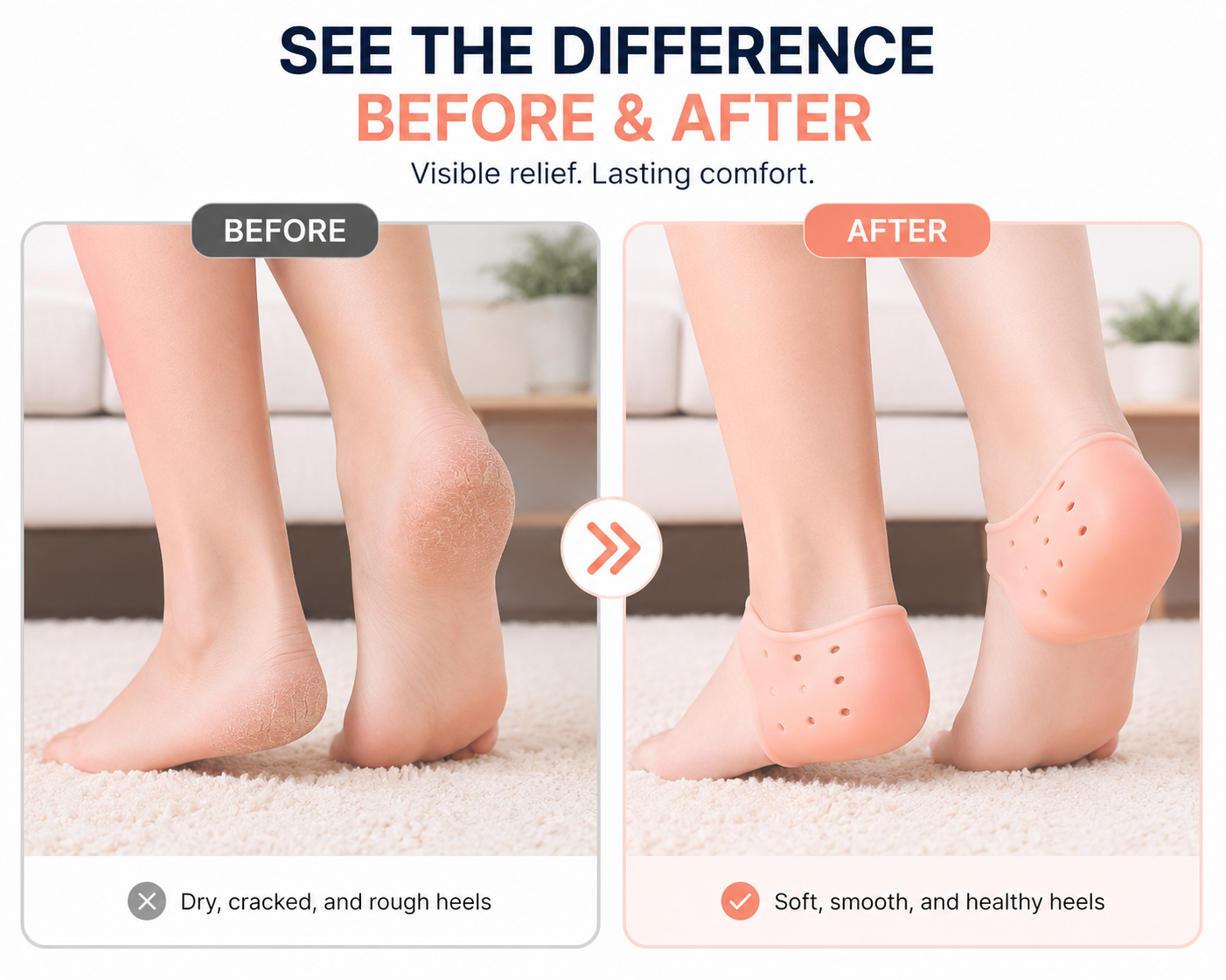 LUXERIN Recovery Heel Pads before and after